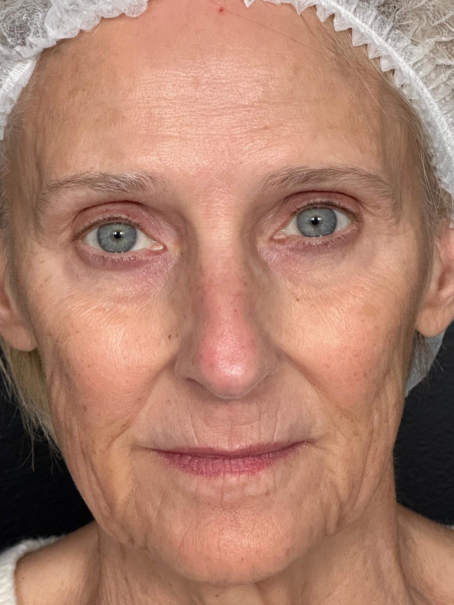 Before Image