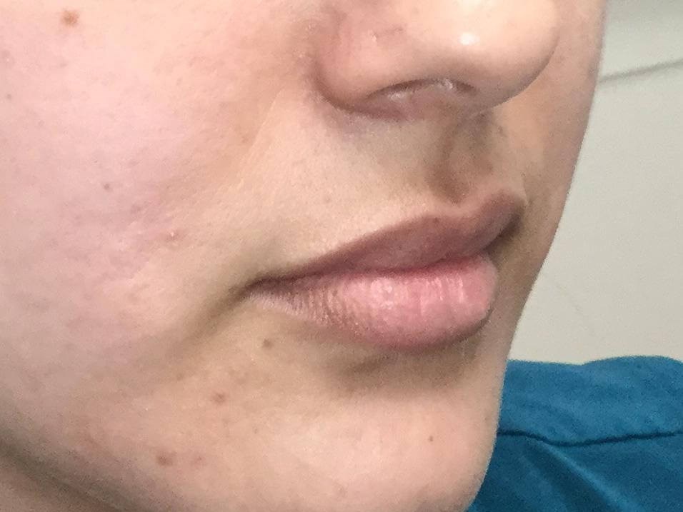 Before Image