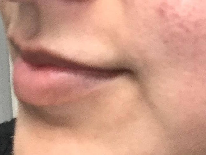 Before Image