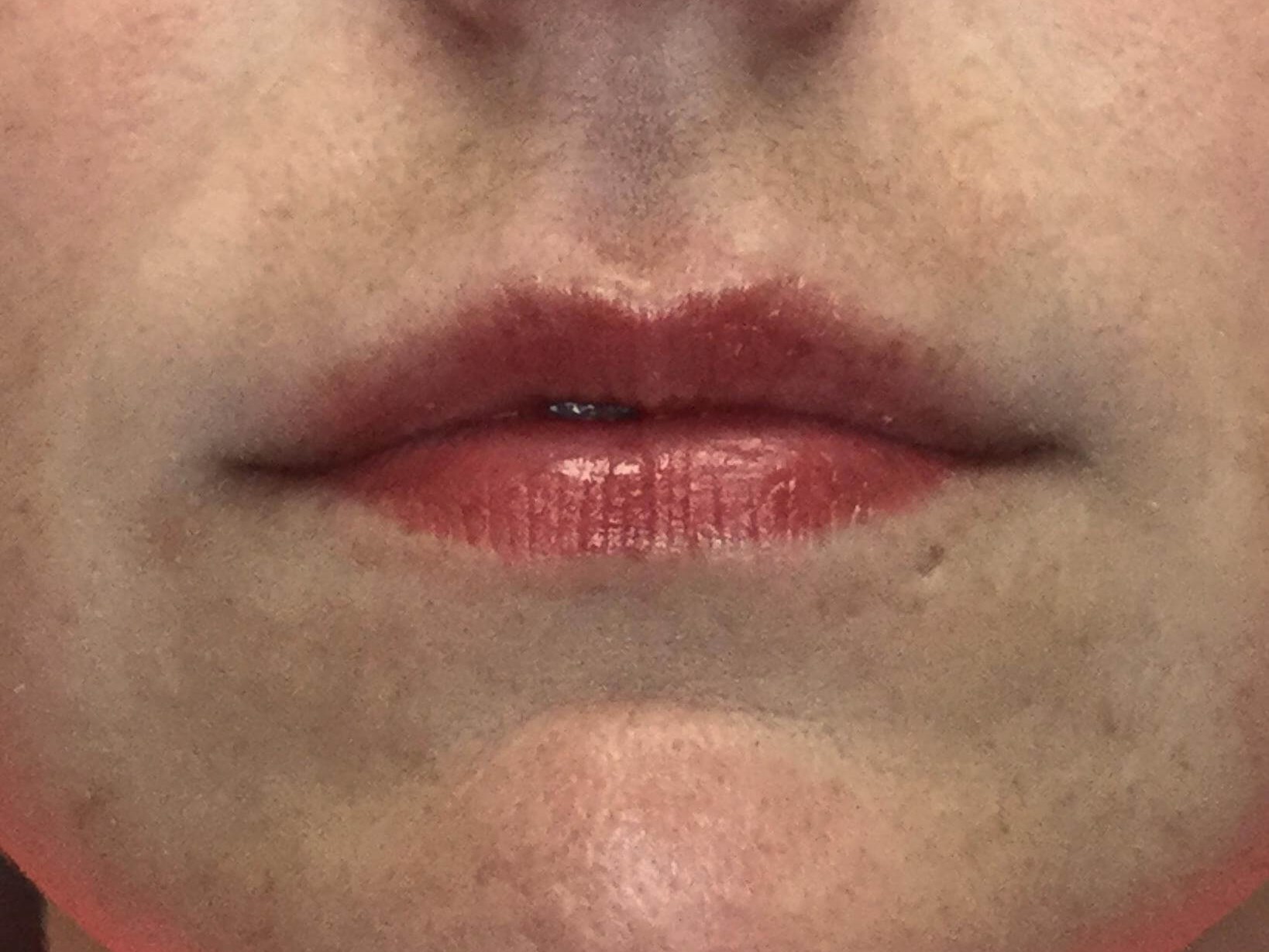 Before Image
