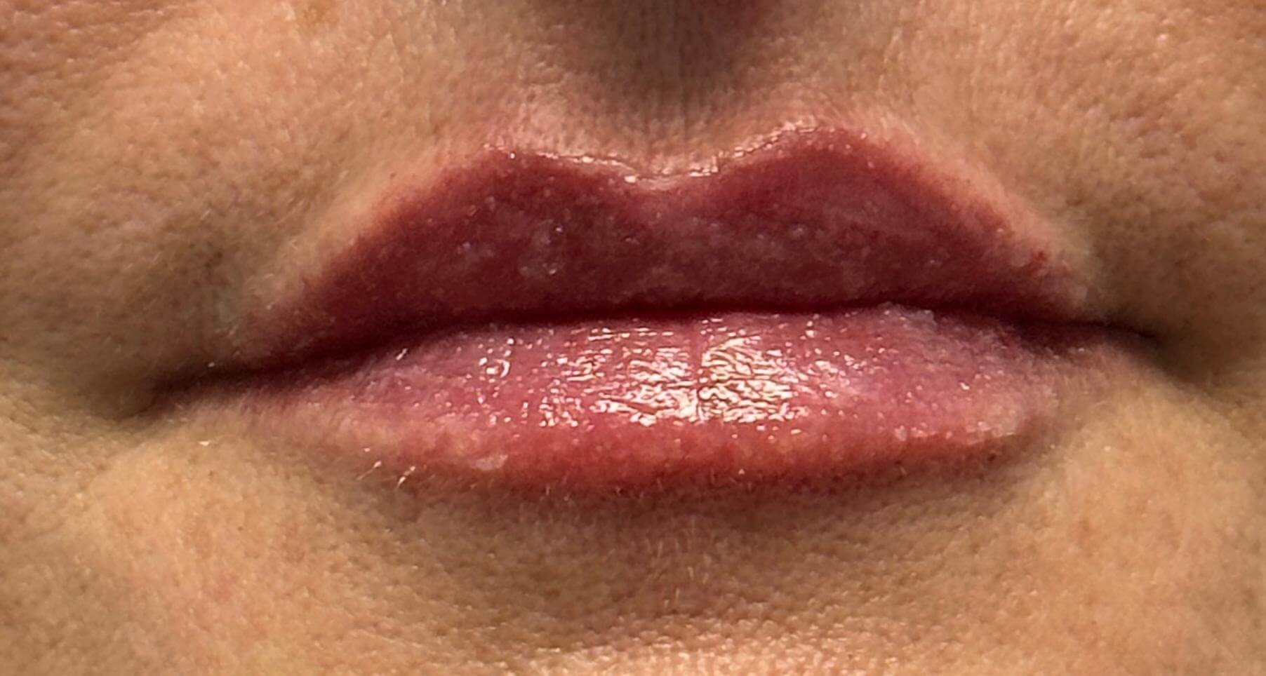 After Image