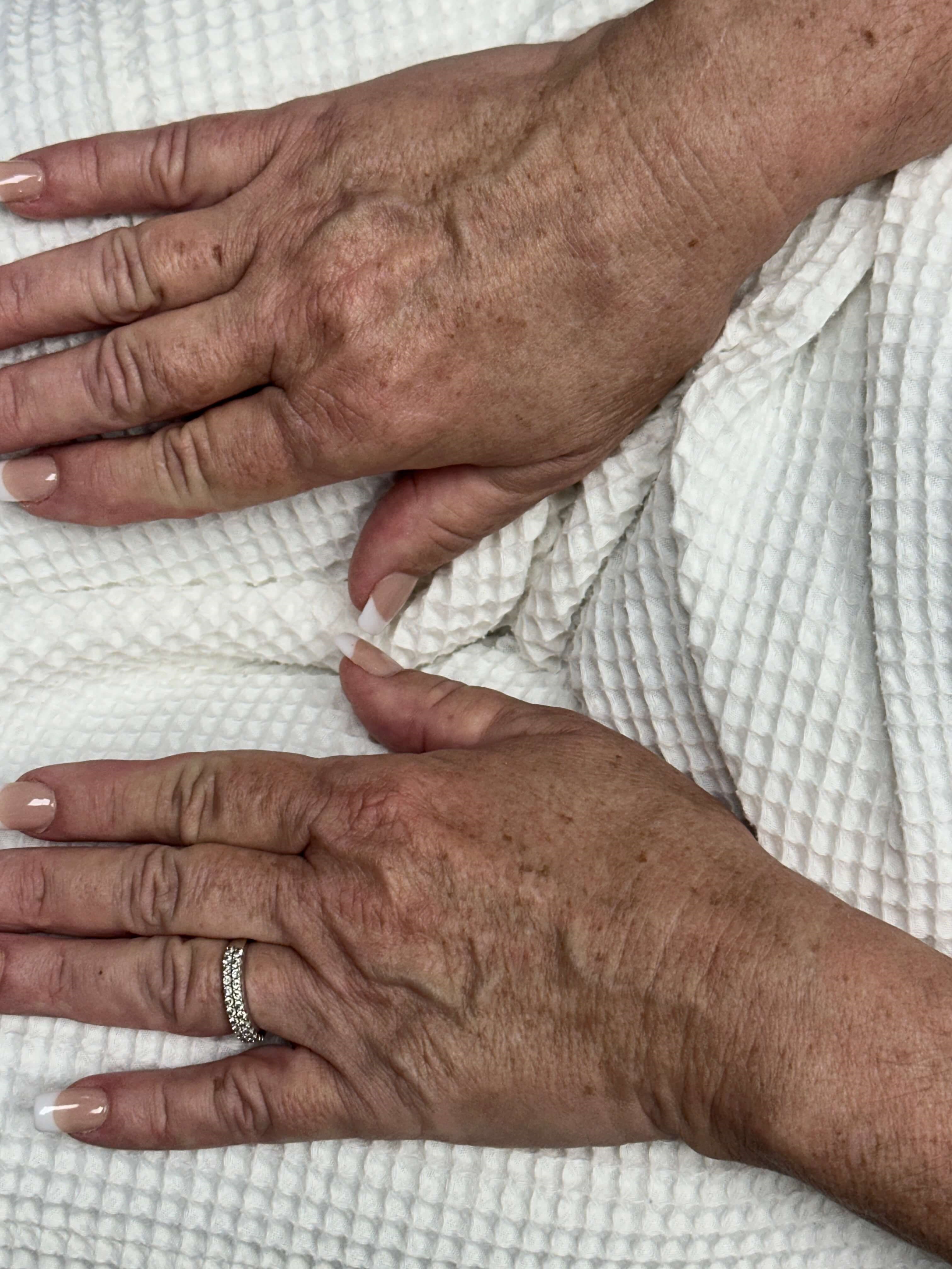 Hands Before