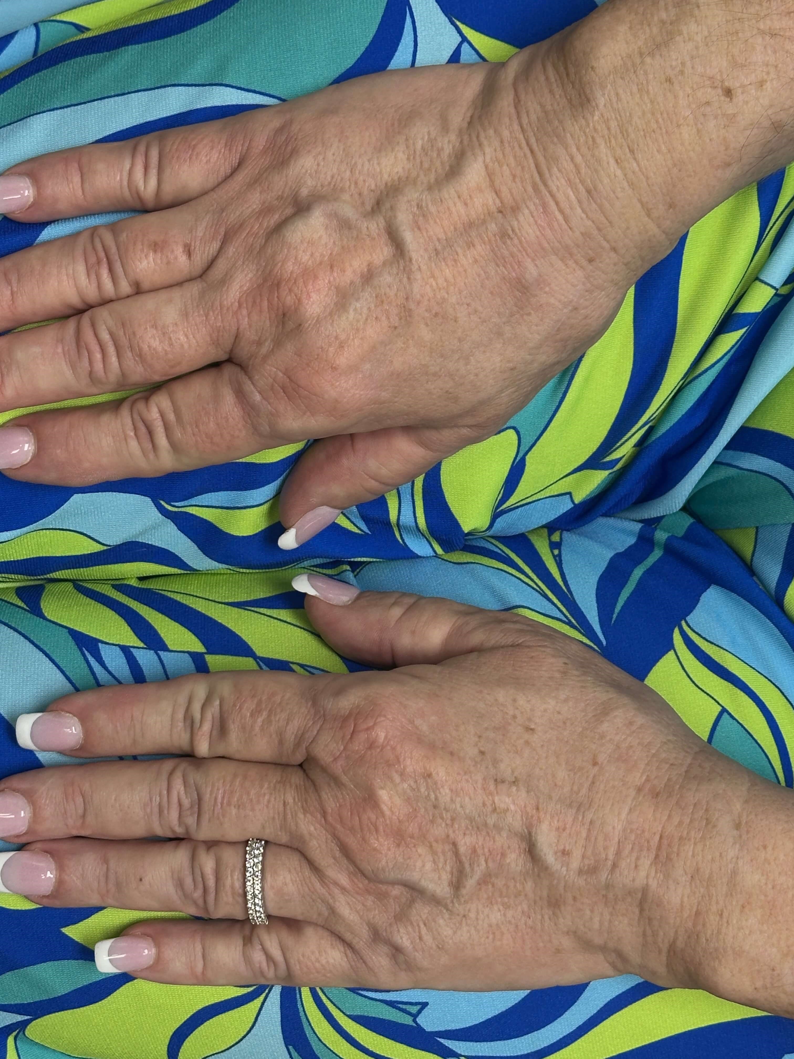 Hands After