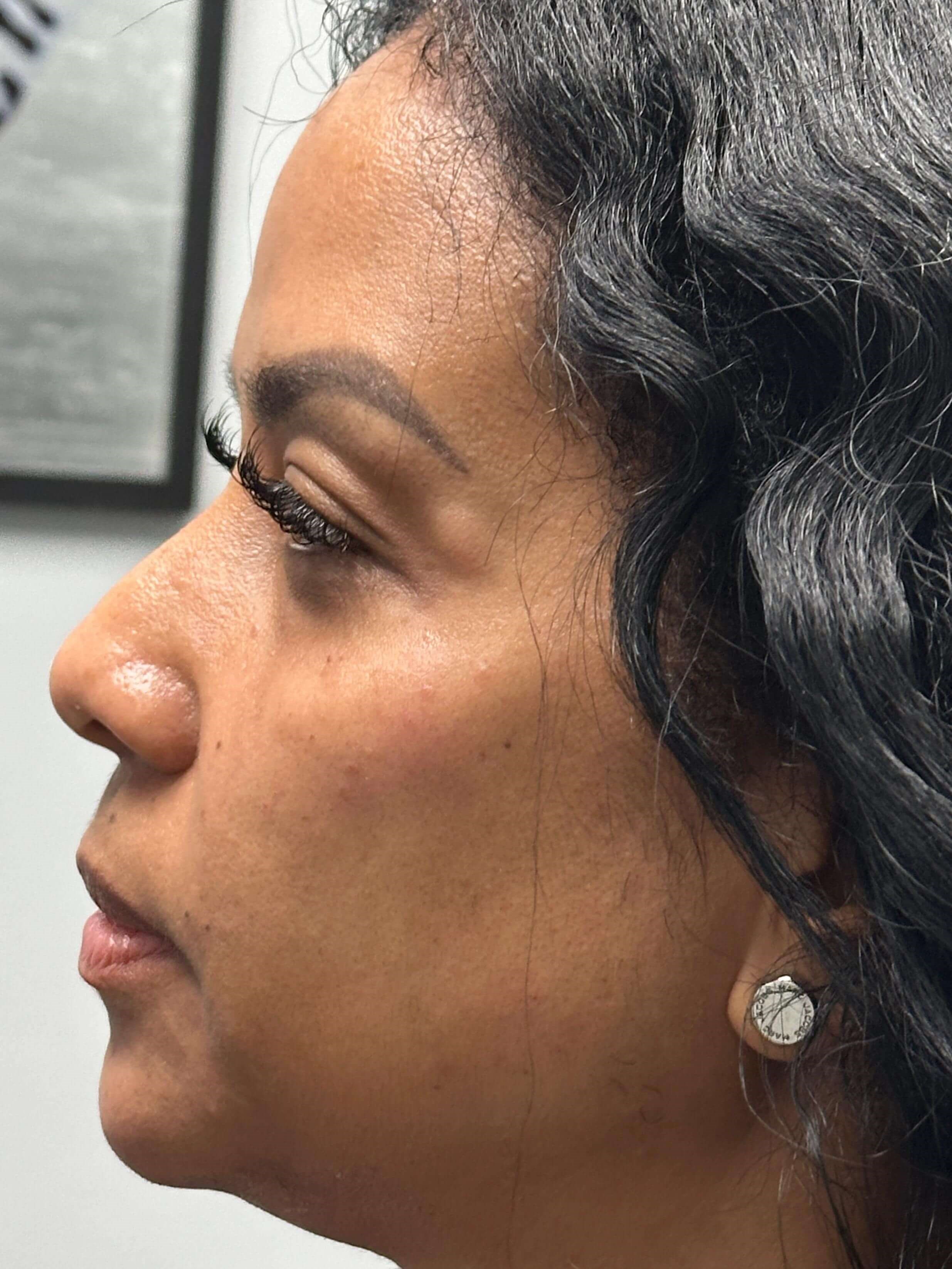 Profile View After