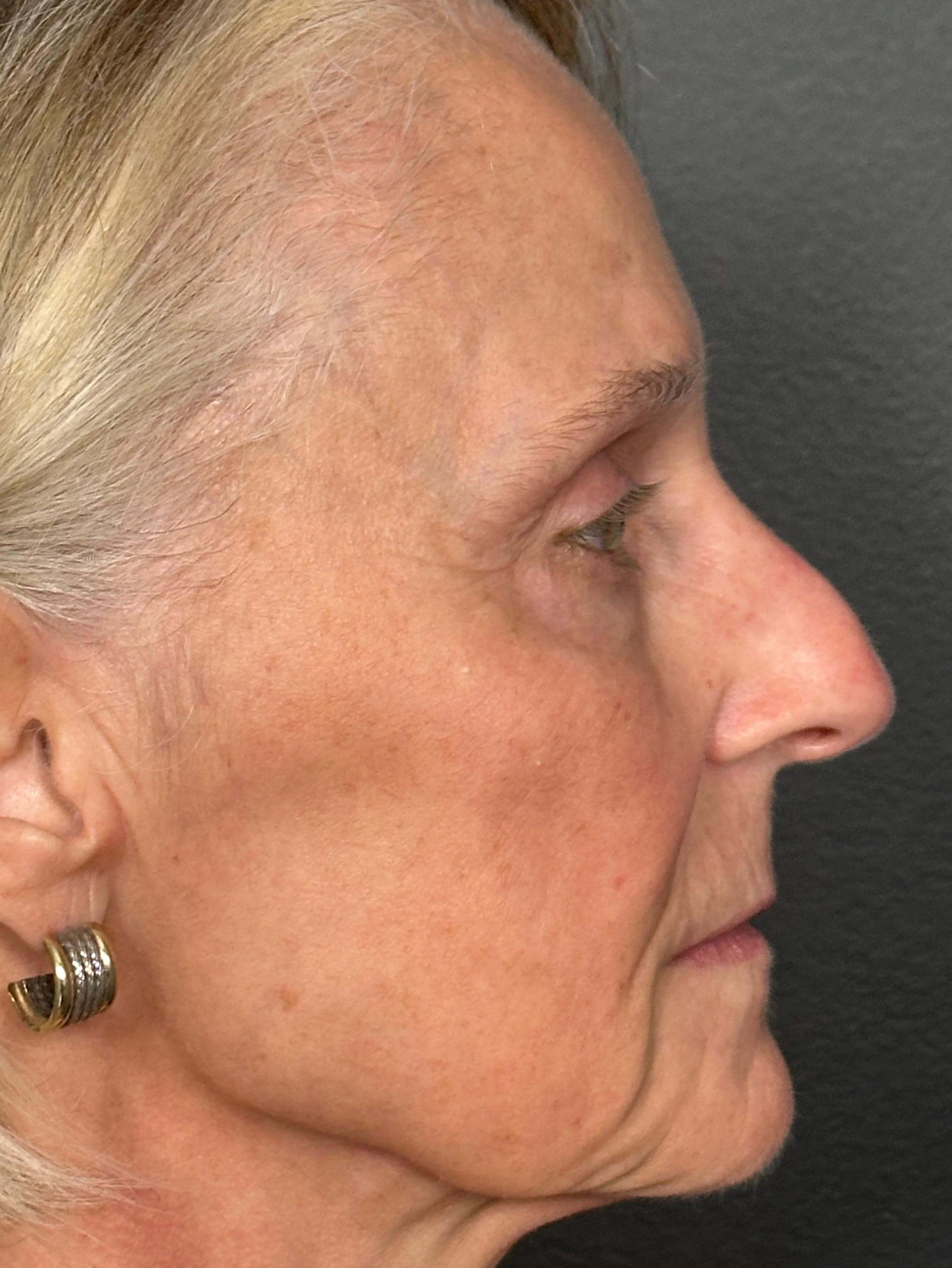 Profile View After