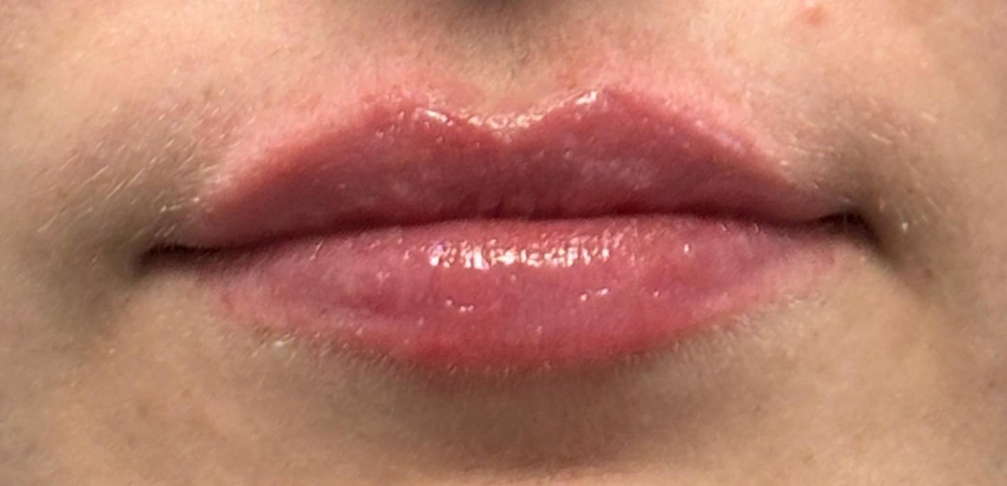 After Image