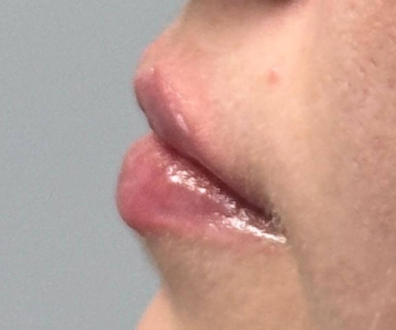 Profile View After