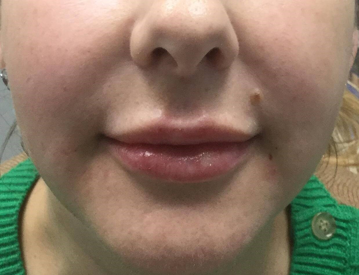 After Image