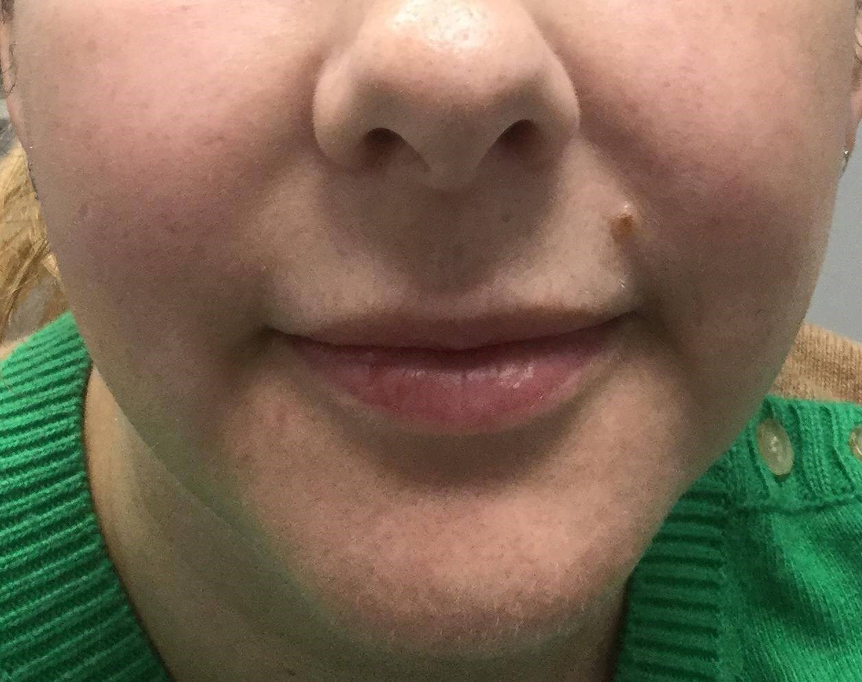Before Image