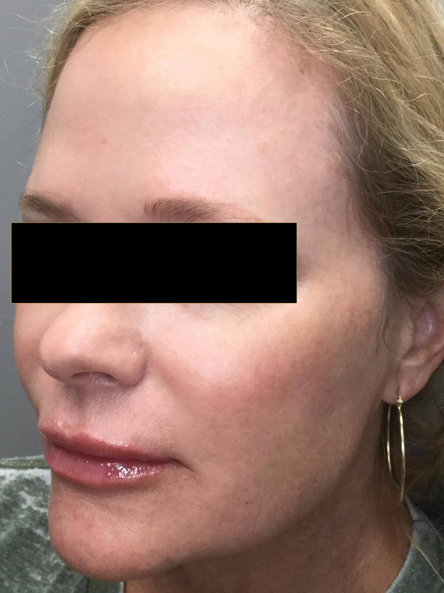 After Image