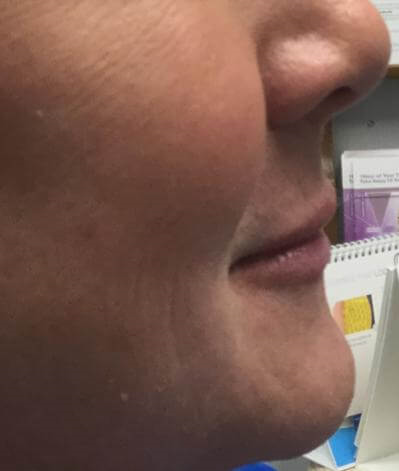 Profile View After