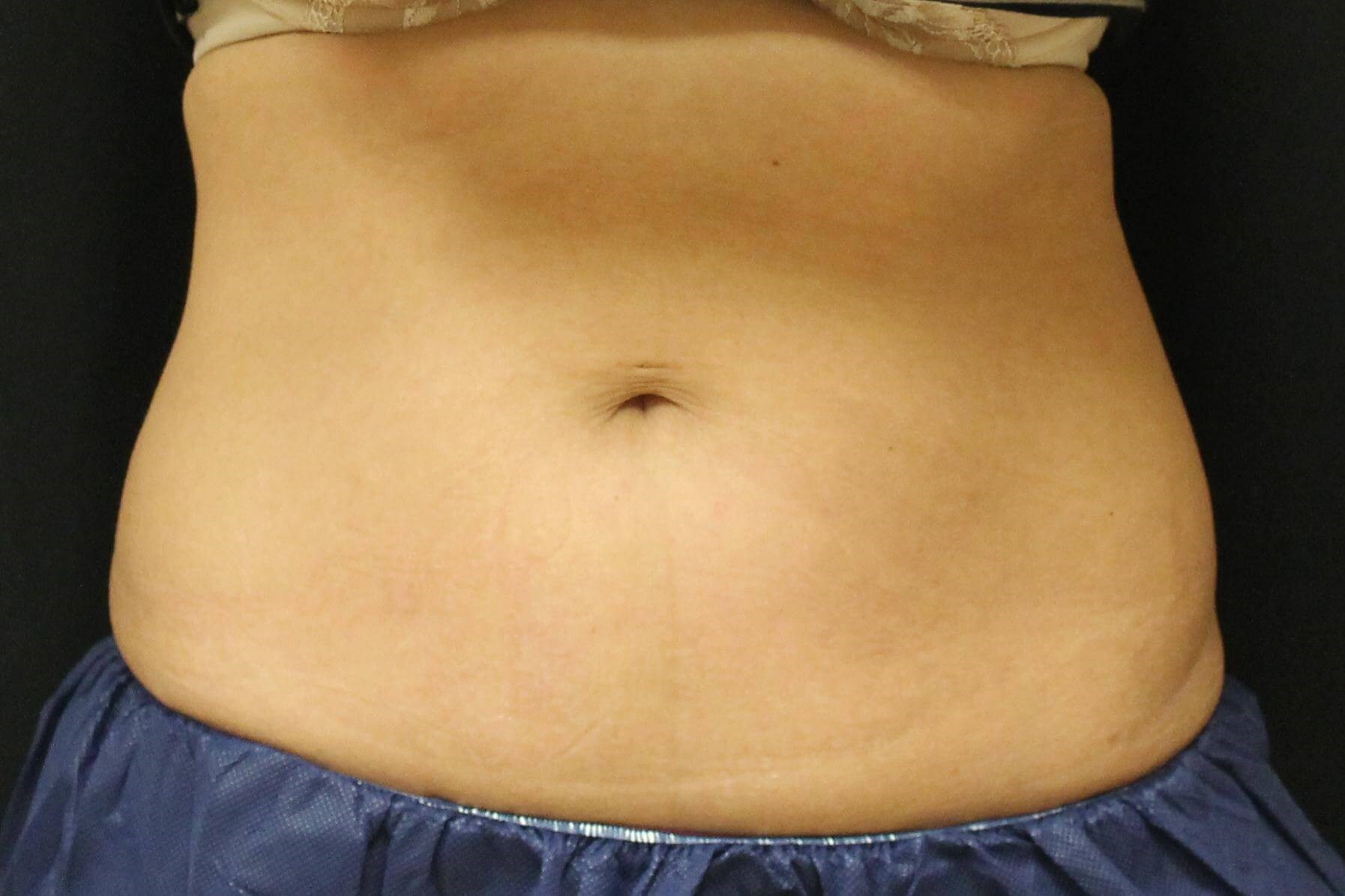 After Image