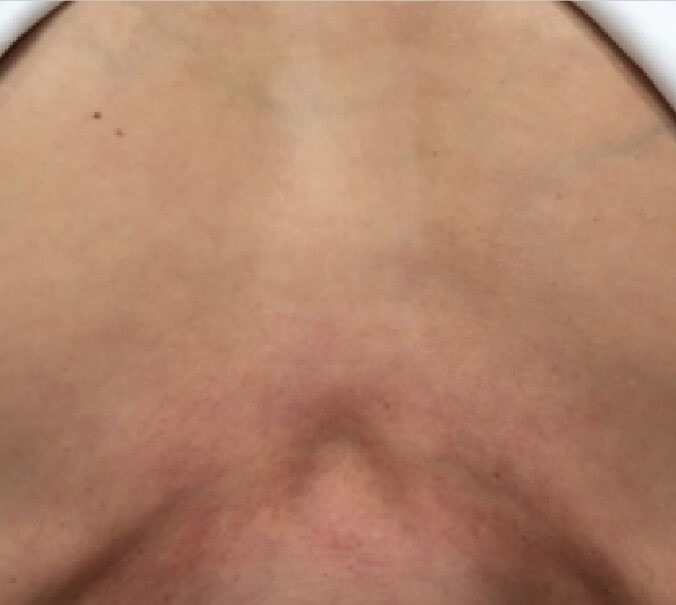 After Image