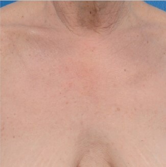 After Image