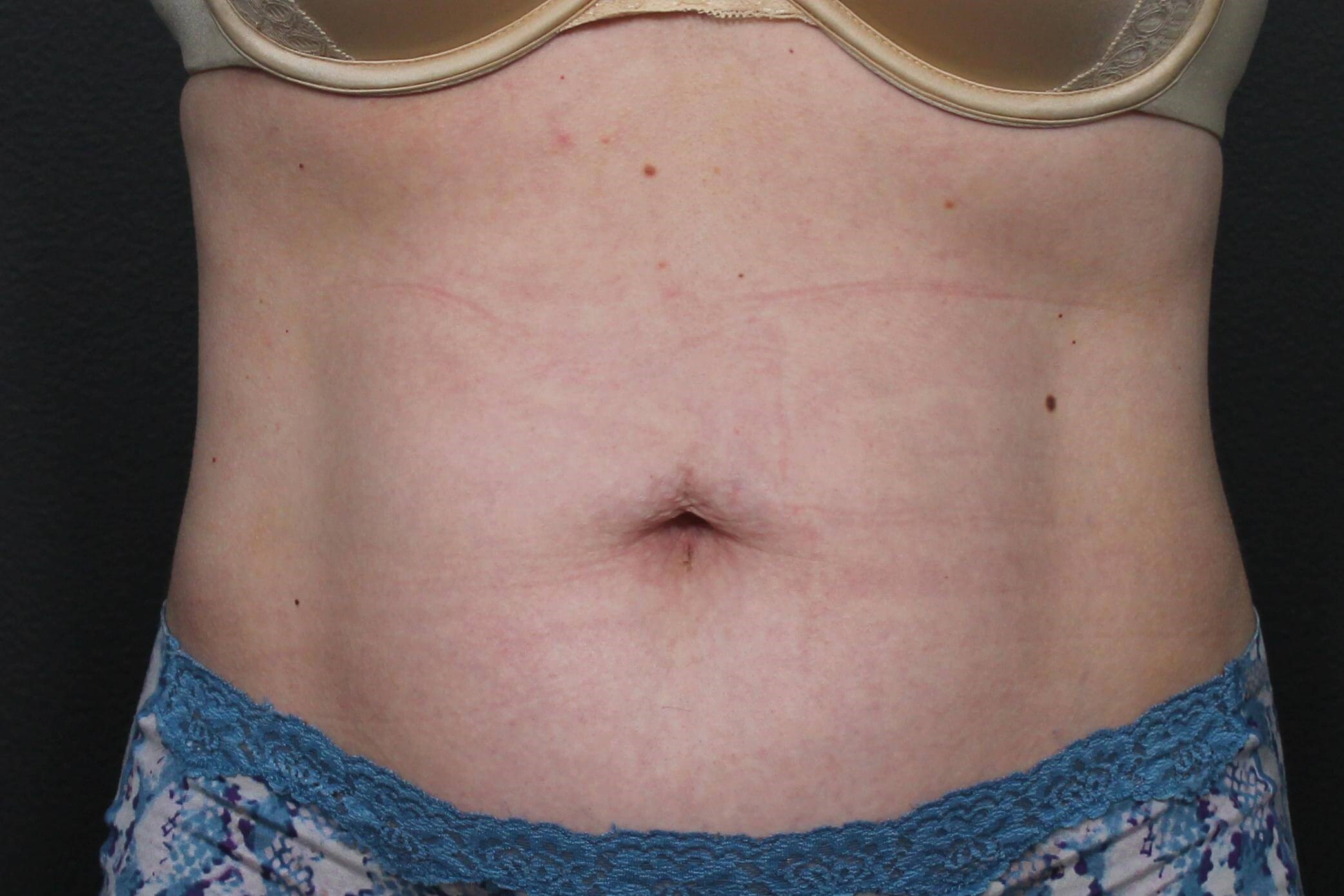 After Image