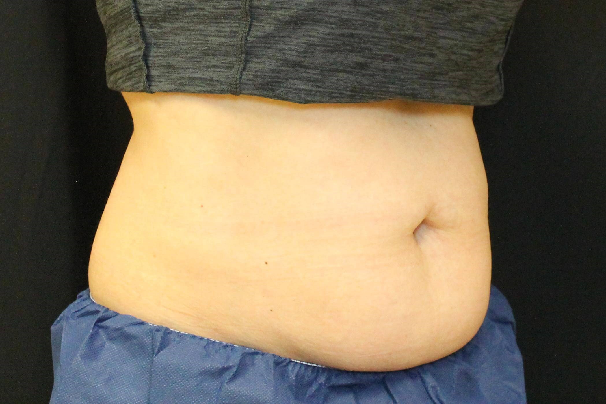 45 View Before