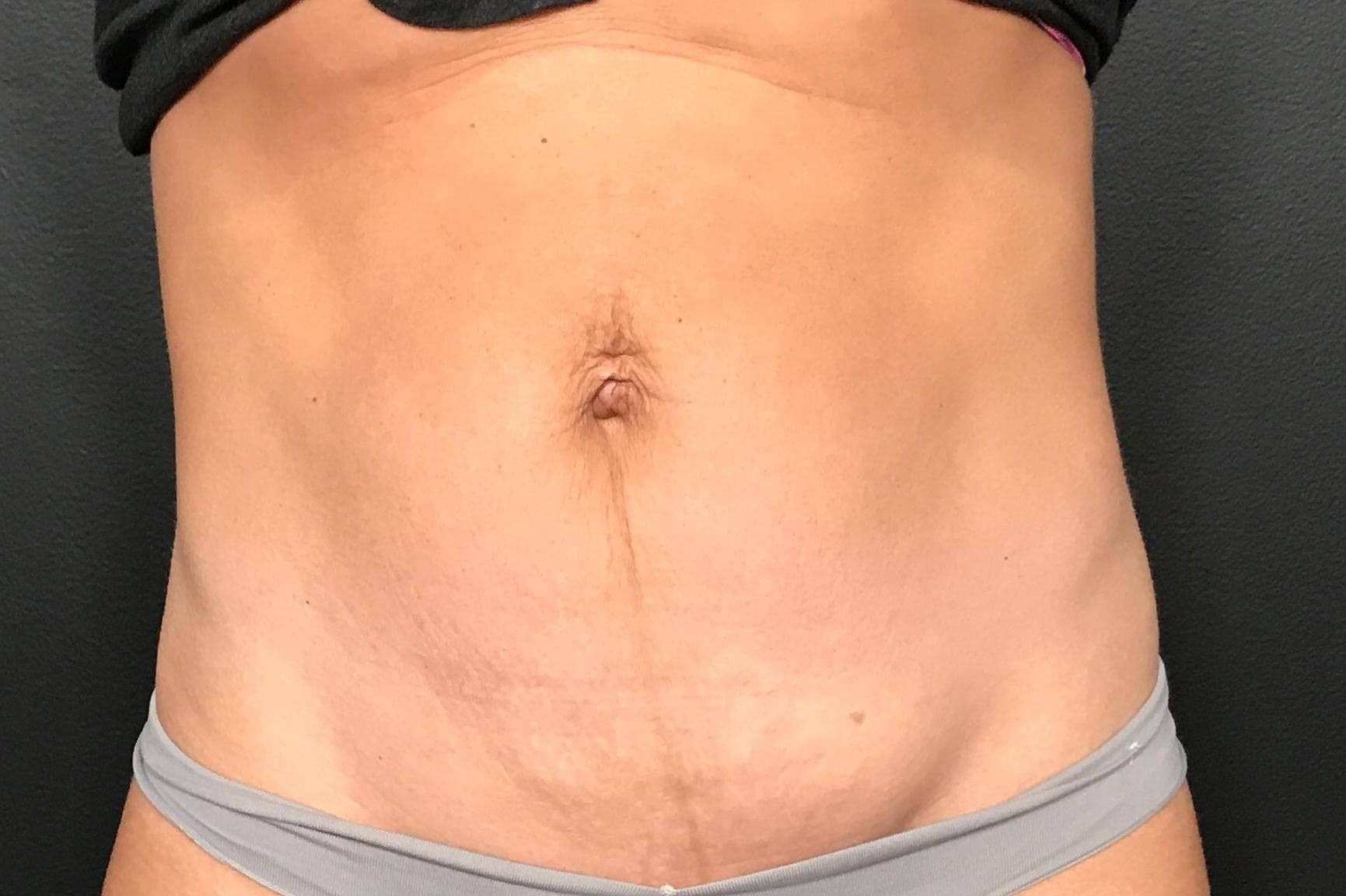 After Image