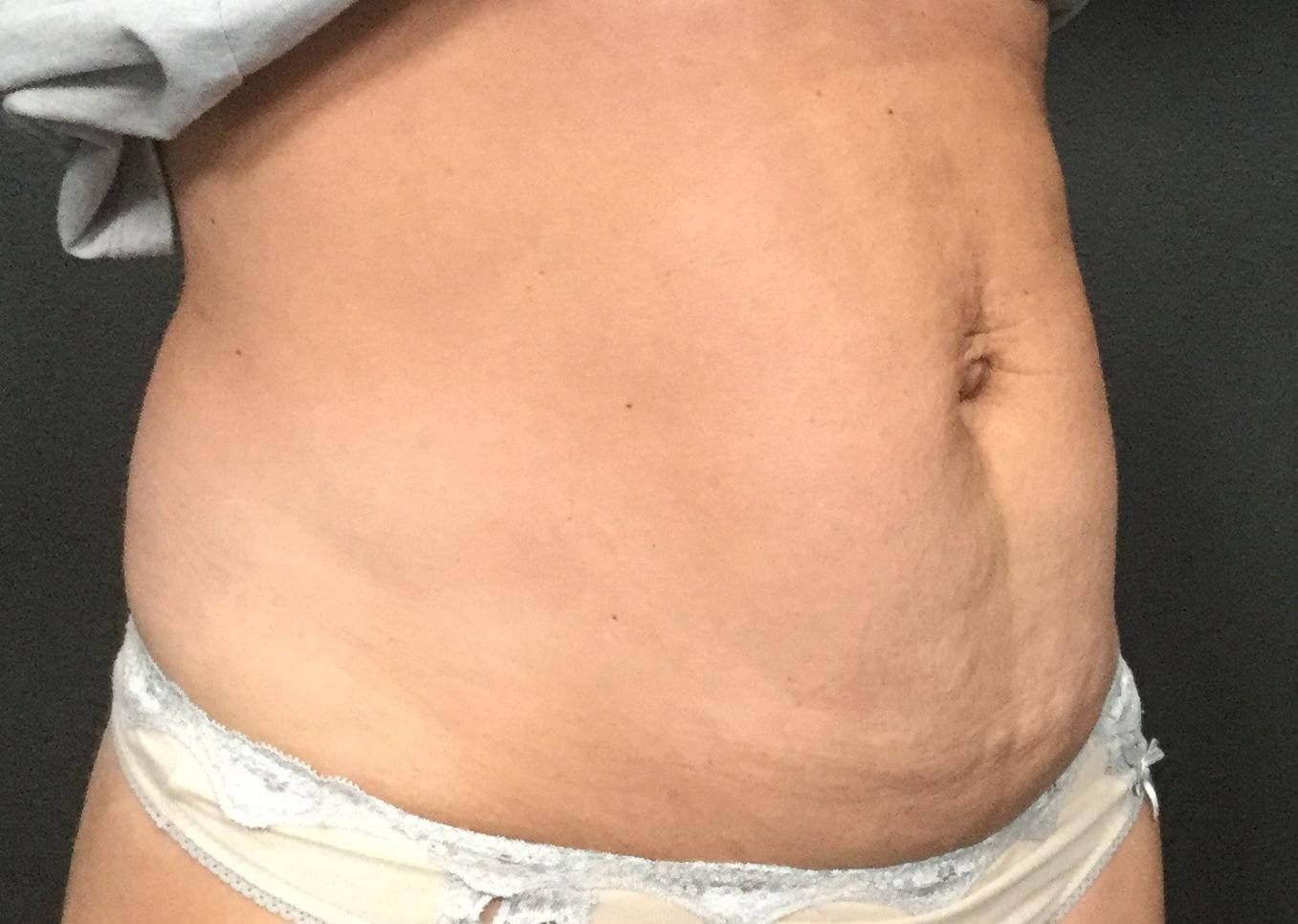 45 View Before